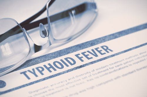 Under Detection Leaves Typhoid Incidence Potentially Underestimated