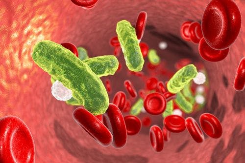 4 Sepsis Phenotypes Identified by Study Raise Hope for Targeted Treatment