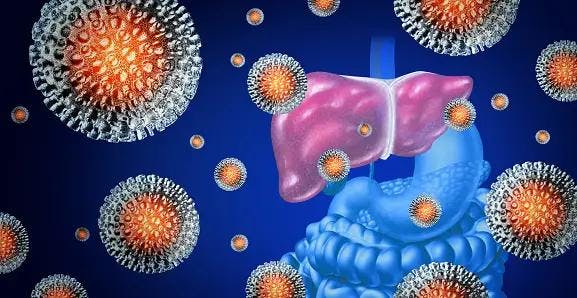 Lysyl oxidase-like 2 (LOXL2) Emerges as a Predictor of Liver Cancer Risk in HCV Patients After Successful Treatment