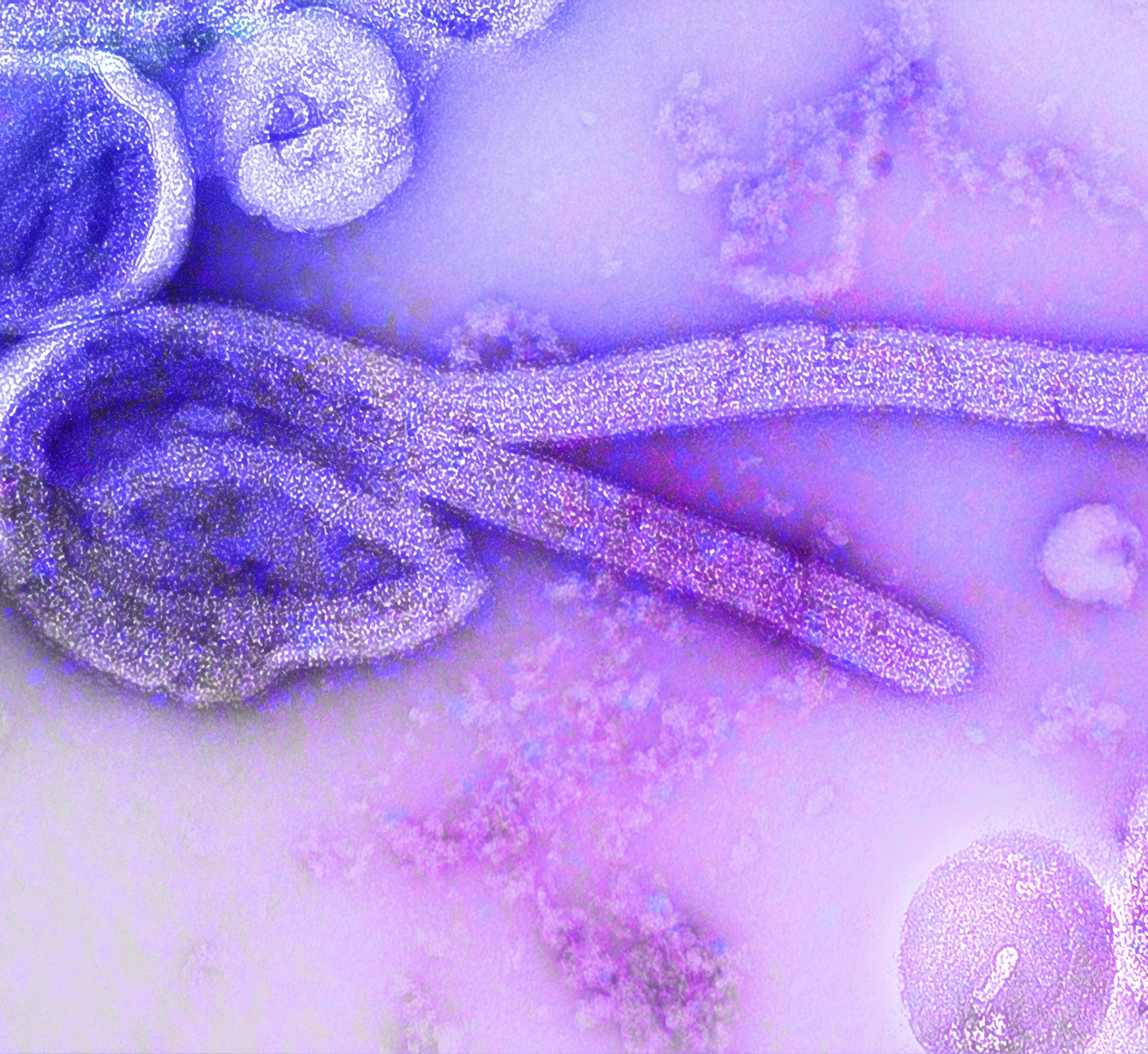 Ebola Virus Cases Reach 23 in Guinea, Africa Through Early 2021