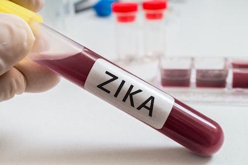 Texas Health Officials Recommend Additional Zika Testing