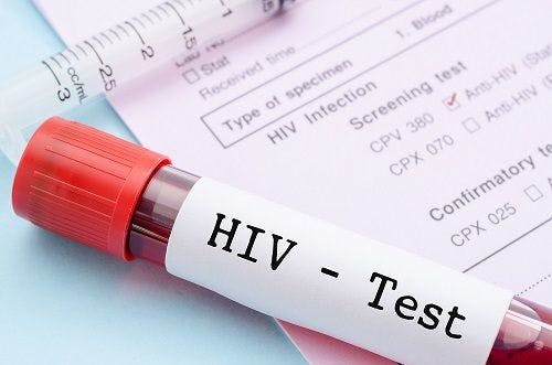 New Study Identifies Most Beneficial Age for One-Time HIV Screening Test