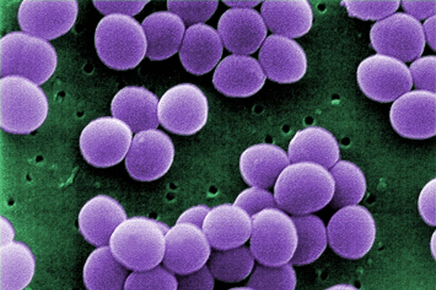Staphylococcus aureus Bloodstream Infection Originating From the Urinary Tract: Characteristics and 30-day Mortality