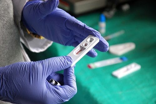 At-Home STI/HIV Testing Could Increase Screening Rates