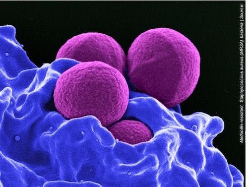 Proactive WGS Offers a Cost-Effective Tool for MRSA Infection Control