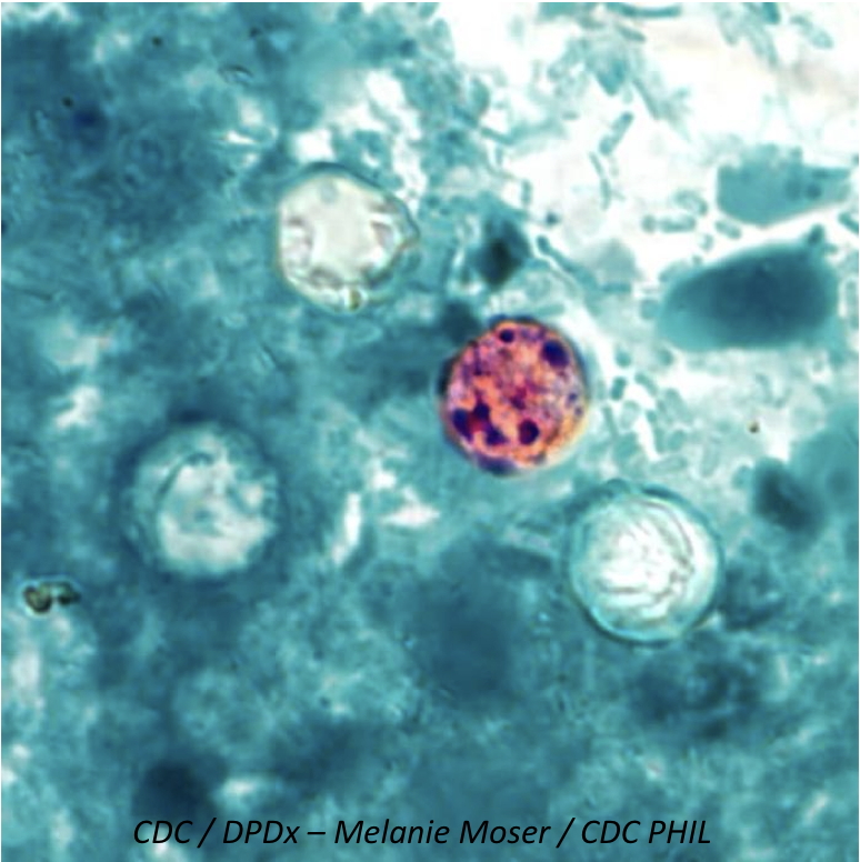 Multistate Outbreak of Cyclospora Connected to Pre-Packaged Vegetable Trays