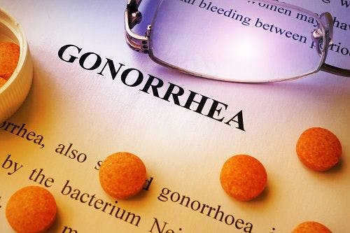 Drug-Resistant Strain of Gonorrhea Spreads to North America