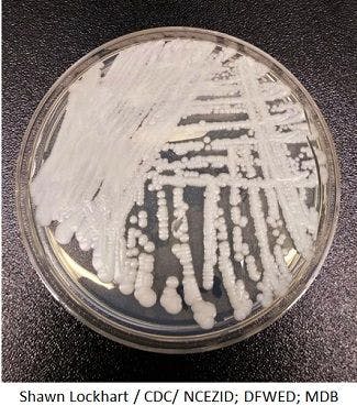 Three Pan-Resistant Candida auris Cases Identified in New York