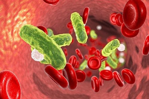 FDA Clears Early Sepsis Indicator