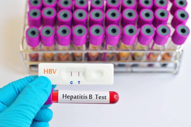 HBV tests | Image credits: Unsplash