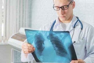 Pneumonia Linked With 43% of Unexpected Infectious Deaths in Study