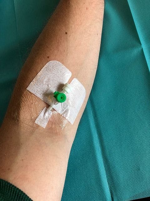 intravenous treatment