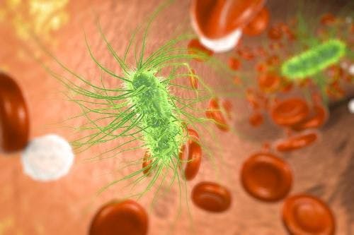 Rapid Blood Assay Predicts Mortality Risk Levels of Sepsis