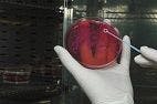 CDC Provides $67 Million to Antibiotic Resistance Efforts