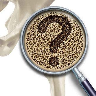 Study Finds Lower Than Expected Bone Density Loss in Regular PrEP Users