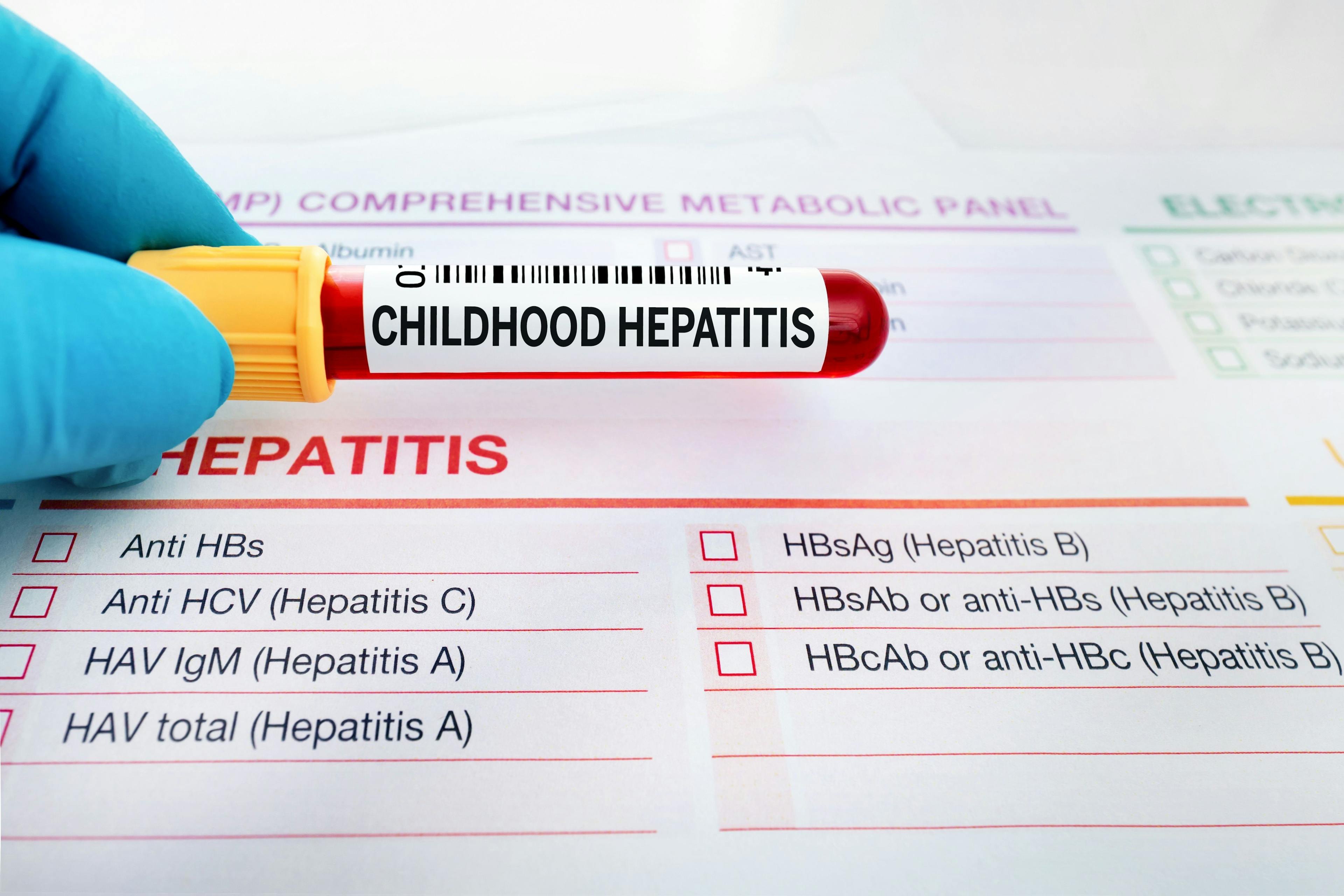 New Guidelines to Diagnose Hepatitis of Unknown Origin in Children