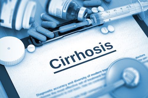 Study Reveals Increased Cirrhosis Prevalence in US Patients with HCV