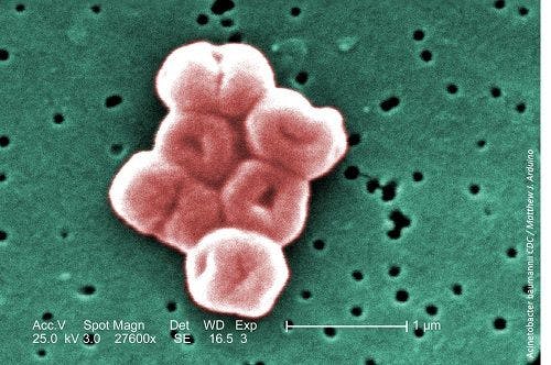 Understanding the New Enemy of Carbapenem-Resistant Acinetobacter Baumannii: Public Health Watch