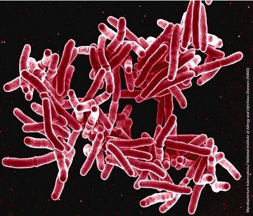 Mutation in TB Gene Associated with Drug Tolerance, Study Finds