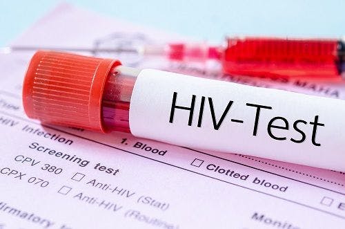 Don't Guess, Get The Test: Increased Testing Key to Stopping HIV Epidemic