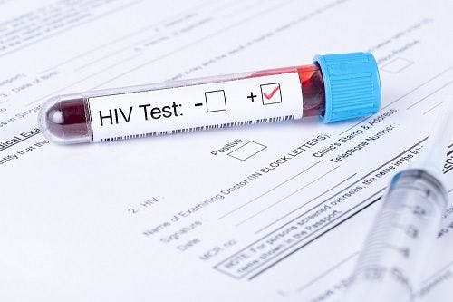 HIV Infection Increases Odds of Severe COVID-19