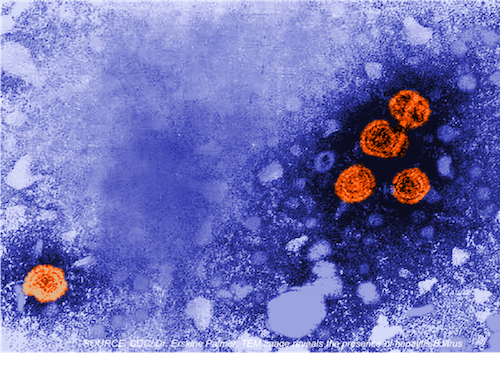 Refugees with HBV Infection Often Do Not Link with Appropriate Long-Term Care