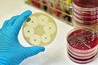 International Report States Global Collaboration Needed to Fight Antimicrobial Resistance