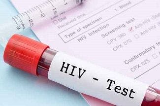 Average Interval Between HIV Tests is 1.4 Years in High-Risk Patients