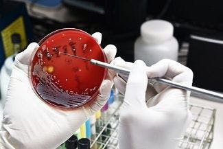 CDC Launches Pilot Program to Accelerate Testing for Antibiotic Resistance