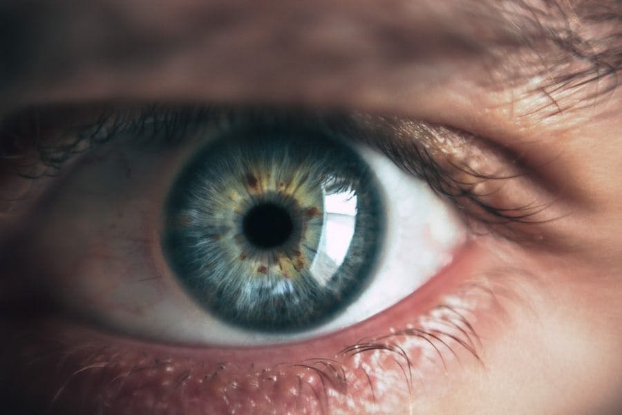 How COVID-19 Impacts the Eyes