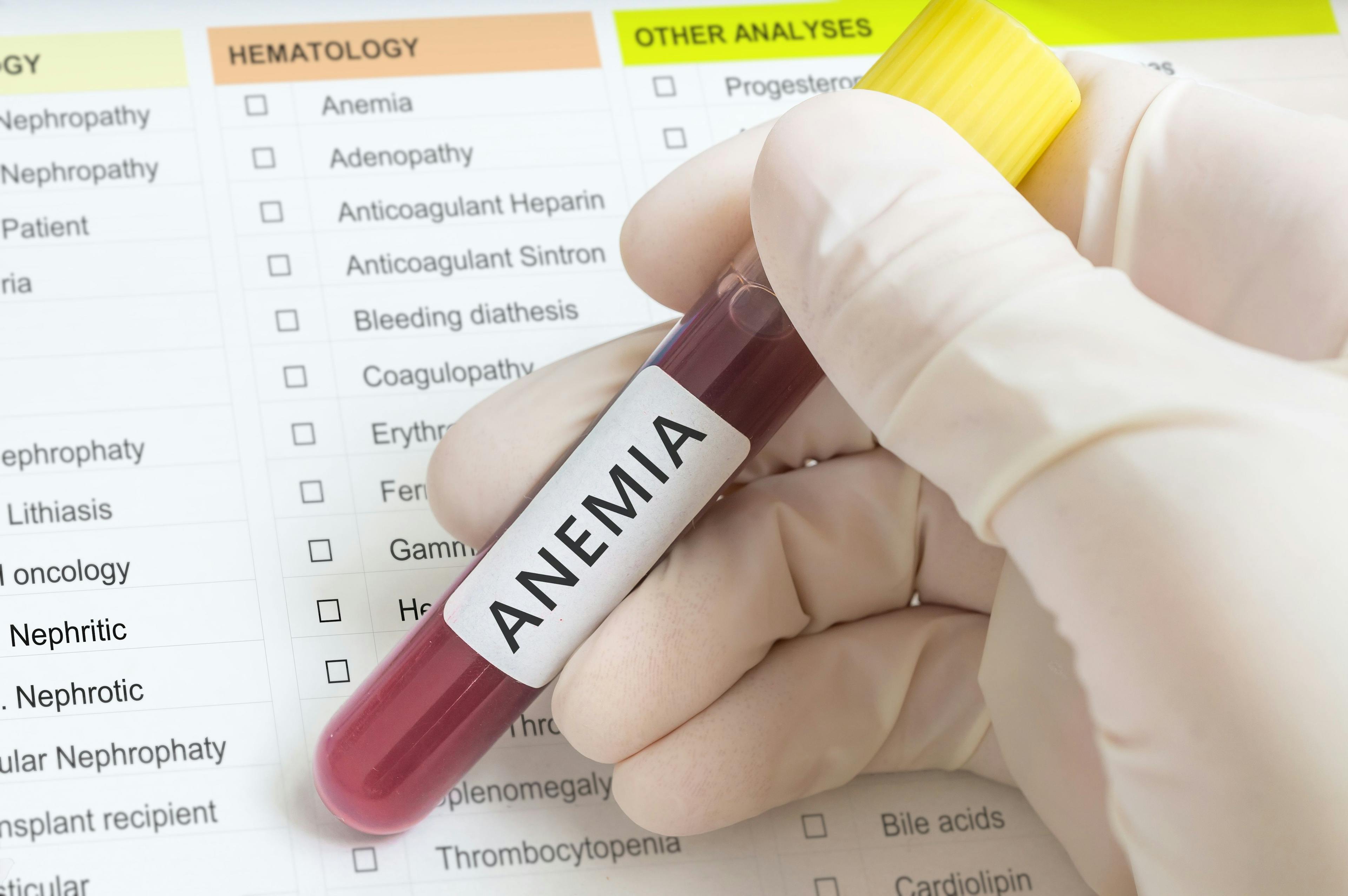 Anemia Significantly Correlated With COVID-19 Mortality