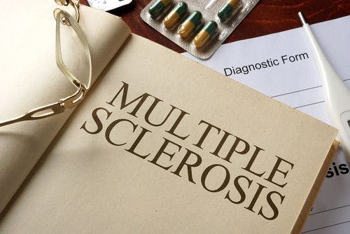Influenza Triggers Immune Responses Resulting in Relapse in Patients with Multiple Sclerosis