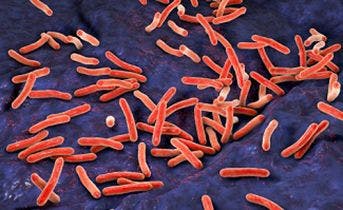 Can DNA Make the Grade in the Fight Against Drug-Resistant TB?&mdash;Public Health Watch