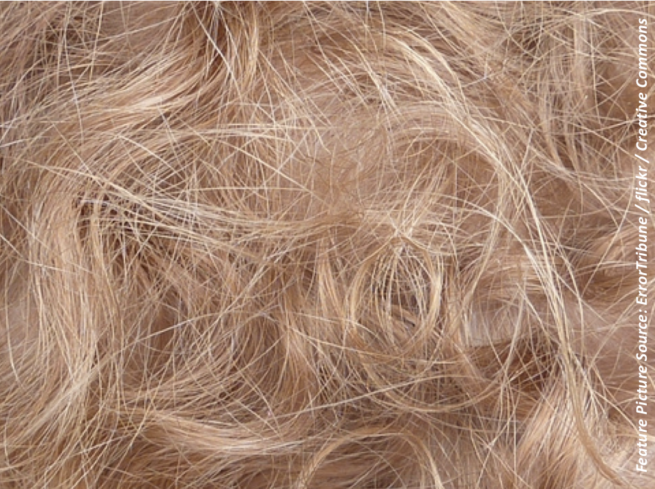 Concentrations of ART in Scalp Hair Correlate with Virologic Response