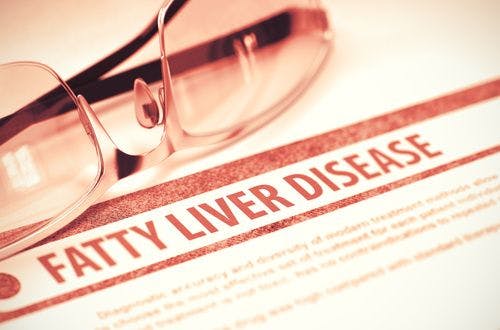 Hepatic Steatosis Affects More HIV Patients without HCV Coinfection