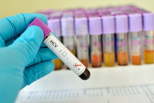 HCV Screening Should Not Just Focus on At-Risk Populations
