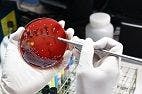 New Tools to Diagnose Superbugs Called for at World Economic Forum