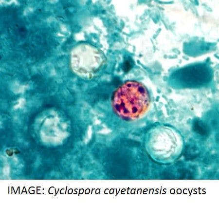 CDC Warns of Increase in Cyclospora cayetanensis Infections in United States