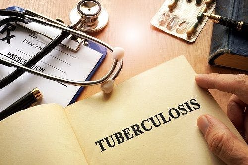 Study Identifies Link Between Vitamin A Levels and Tuberculosis
