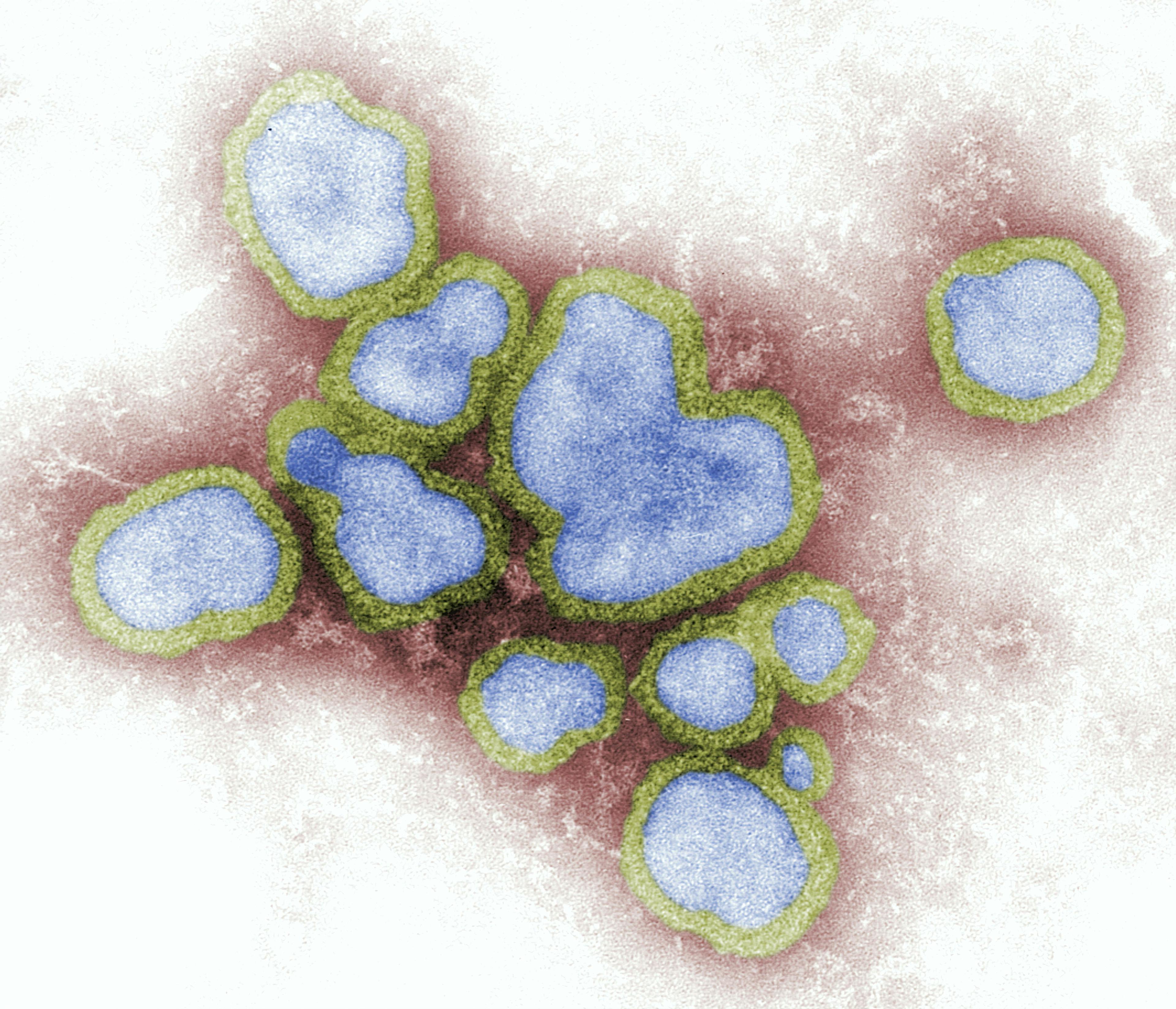Using Lessons Learned from COVID-19 to Prepare for the Next Influenza Pandemic