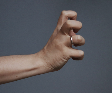 rheumatic disease showing hand 