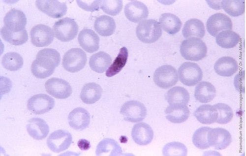 NIH Investigators Discover New Targets for Anti-Malarial Drugs