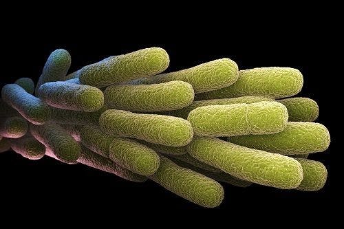 Legionnaires' Disease on the Rise in the United States