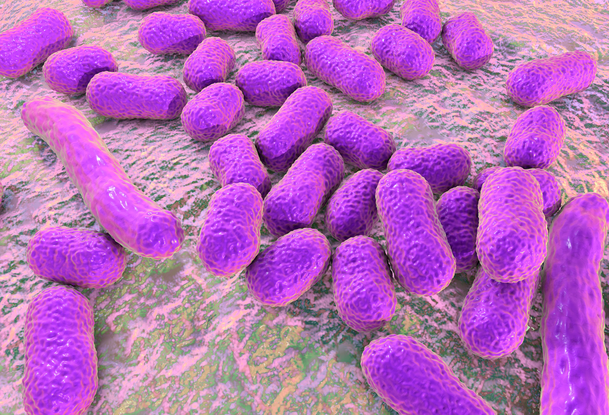 Cefiderocol’s Role in Managing Carbapenem-Resistant Acinetobacter baumannii Infections