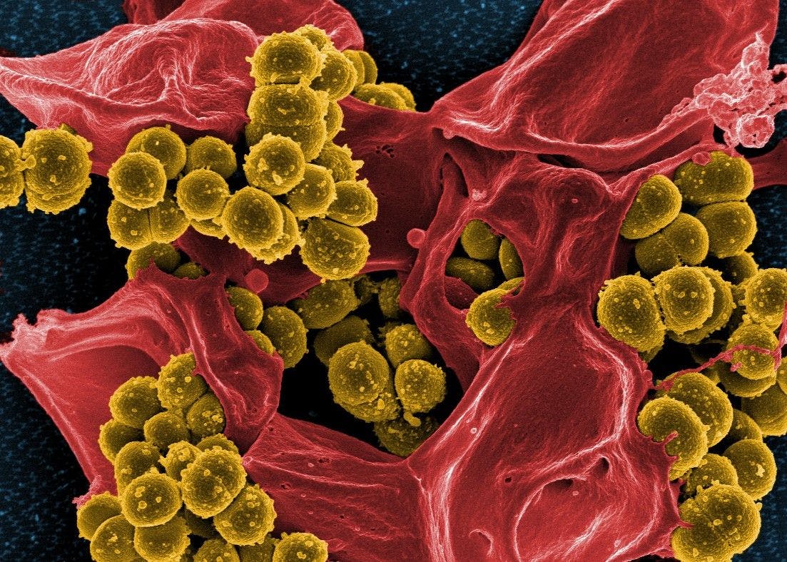 This digitally colorized scanning electron microscopic (SEM) image, depicts numerous mustard-colored, spheroid shaped, methicillin-resistant, Staphylococcus aureus (MRSA) bacteria, enmeshed within the pseudopodia of a red-colored human white blood cell (WBC), known more specifically as a neutrophil. Photo Cedit: National Institute of Allergy and Infectious Diseases