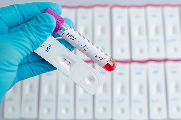 HCV positive tests | Image Credits: Unsplash
