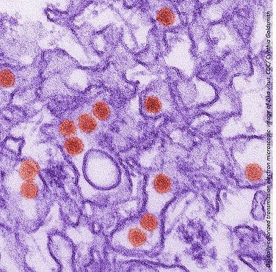 Study Suggests Naturally-Acquired Immunity Against Zika Virus May Already Occur