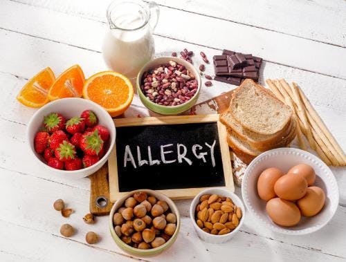 S aureus in Children With Eczema May Play a Role in Development of Food Allergies