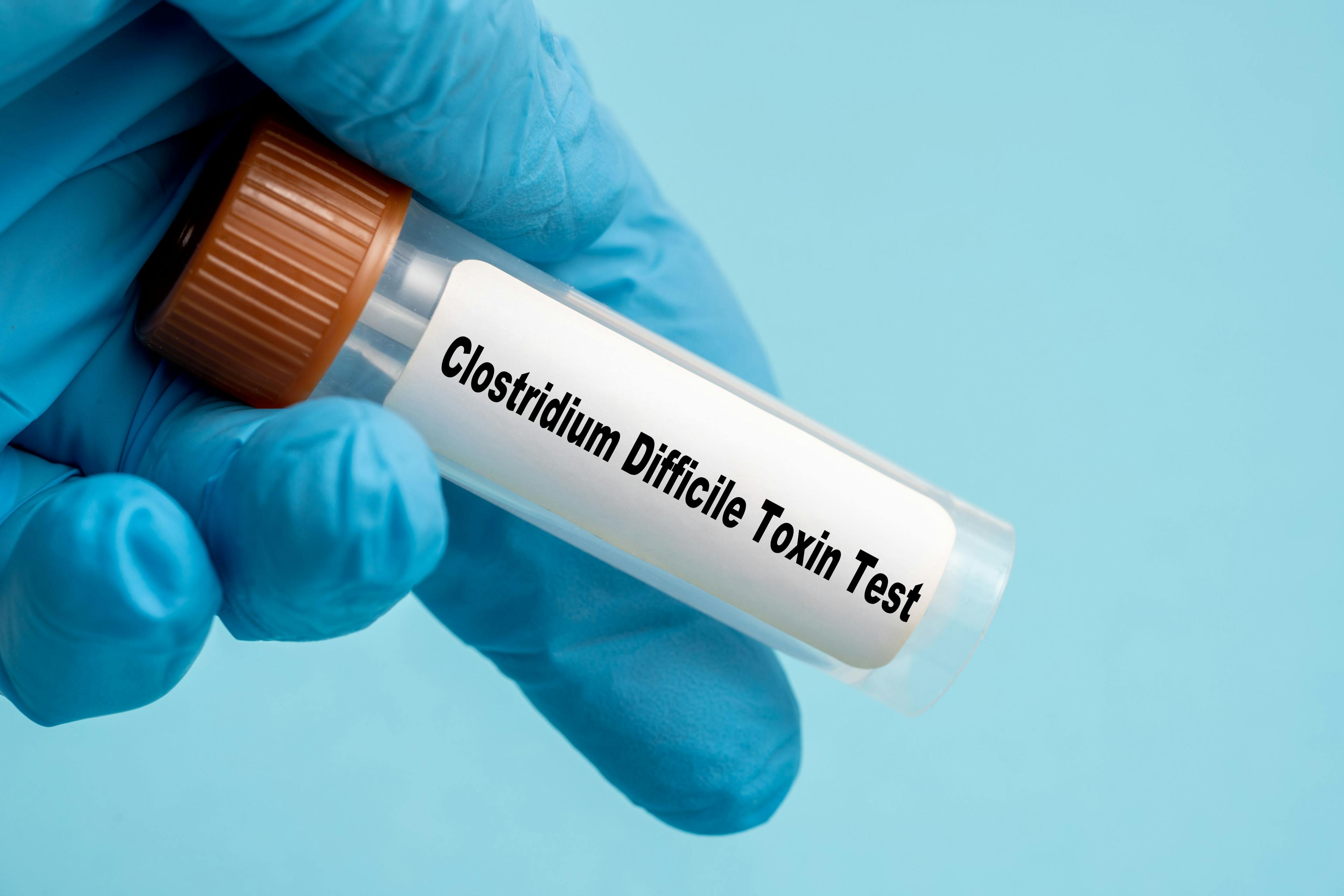 2-Step Testing Helps Predict and Treat Recurrent C difficile Infection