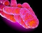 Researchers Have Discovered Best Conditions for Legionella Growth